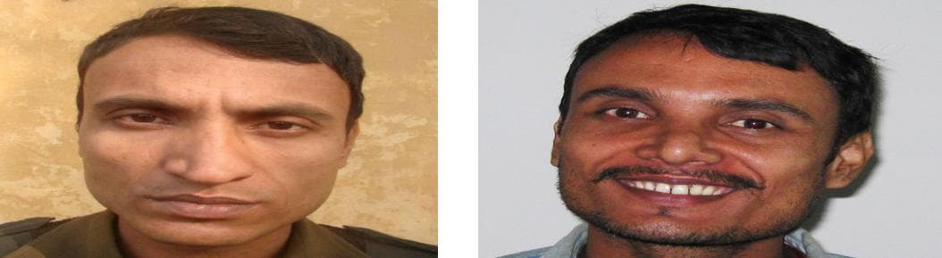 Rhinoplasty17.jpg