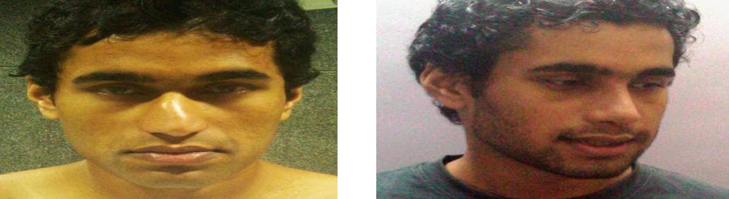 Rhinoplasty5.jpg